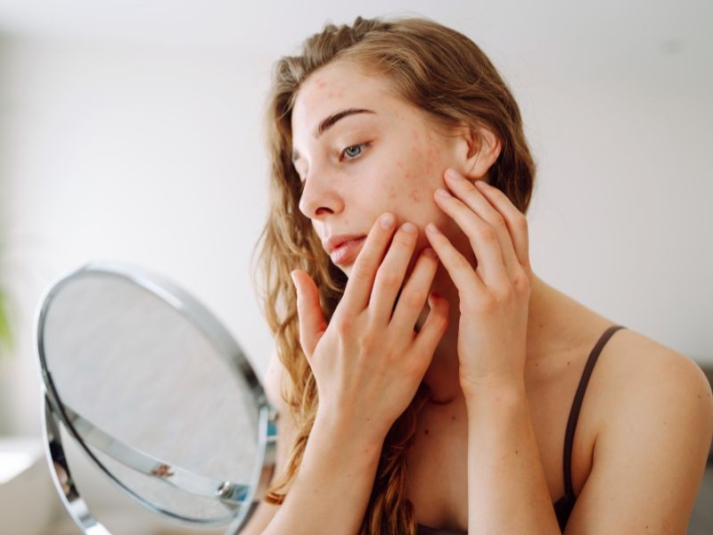 Tratamento Transtorno de Escoriação (Skin-picking)